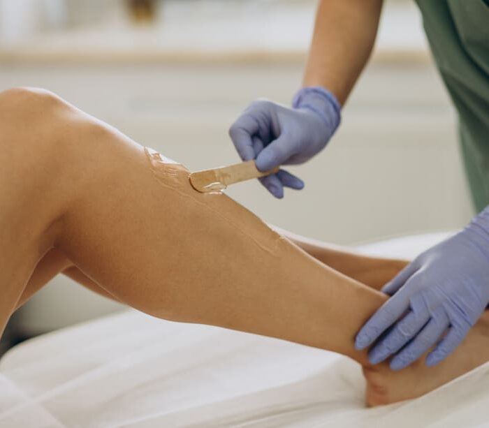 laser-epilation-hair-removal-therapy (1) depilacion profesional