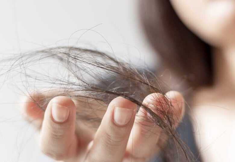 tratamientos capilares problemas capilares